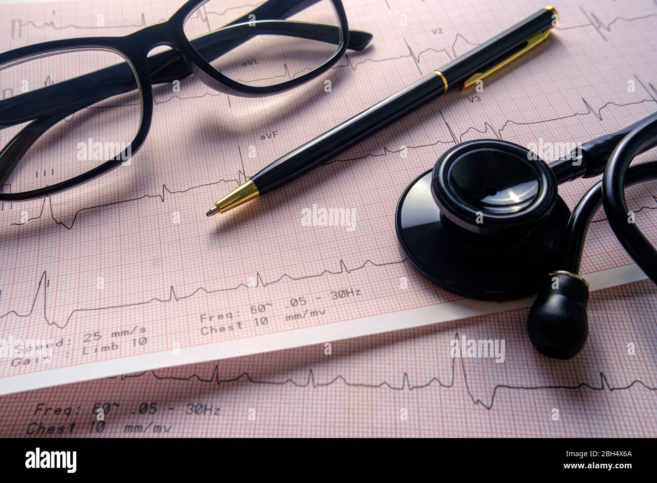 Stethoskop, Brille und Stift auf Elektrokardiogramm Stockfoto