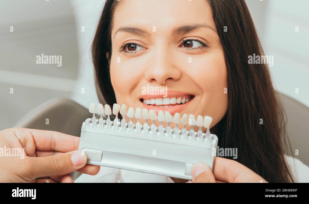 Zähne Palette mit verschiedenen Schattierungen von Zähnen in der Nähe von weiblichen lächelnd. Stomatologie, Zahnweiß, Zahnimplantat Stockfoto