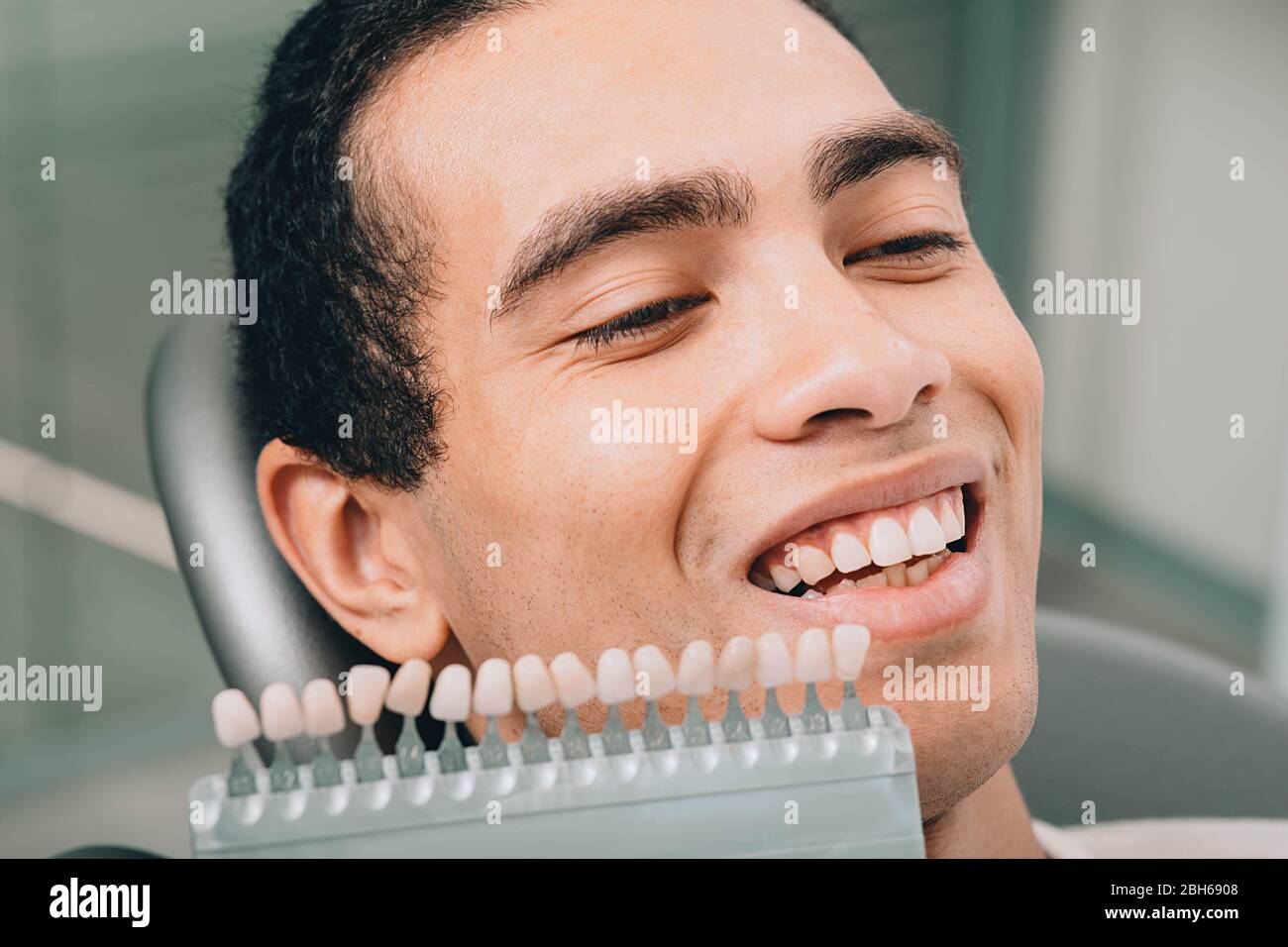 Zähne Farbpalette in der Nähe von männlichen Mund. afroamerikanischer Mann in der Zahnklinik Stockfoto