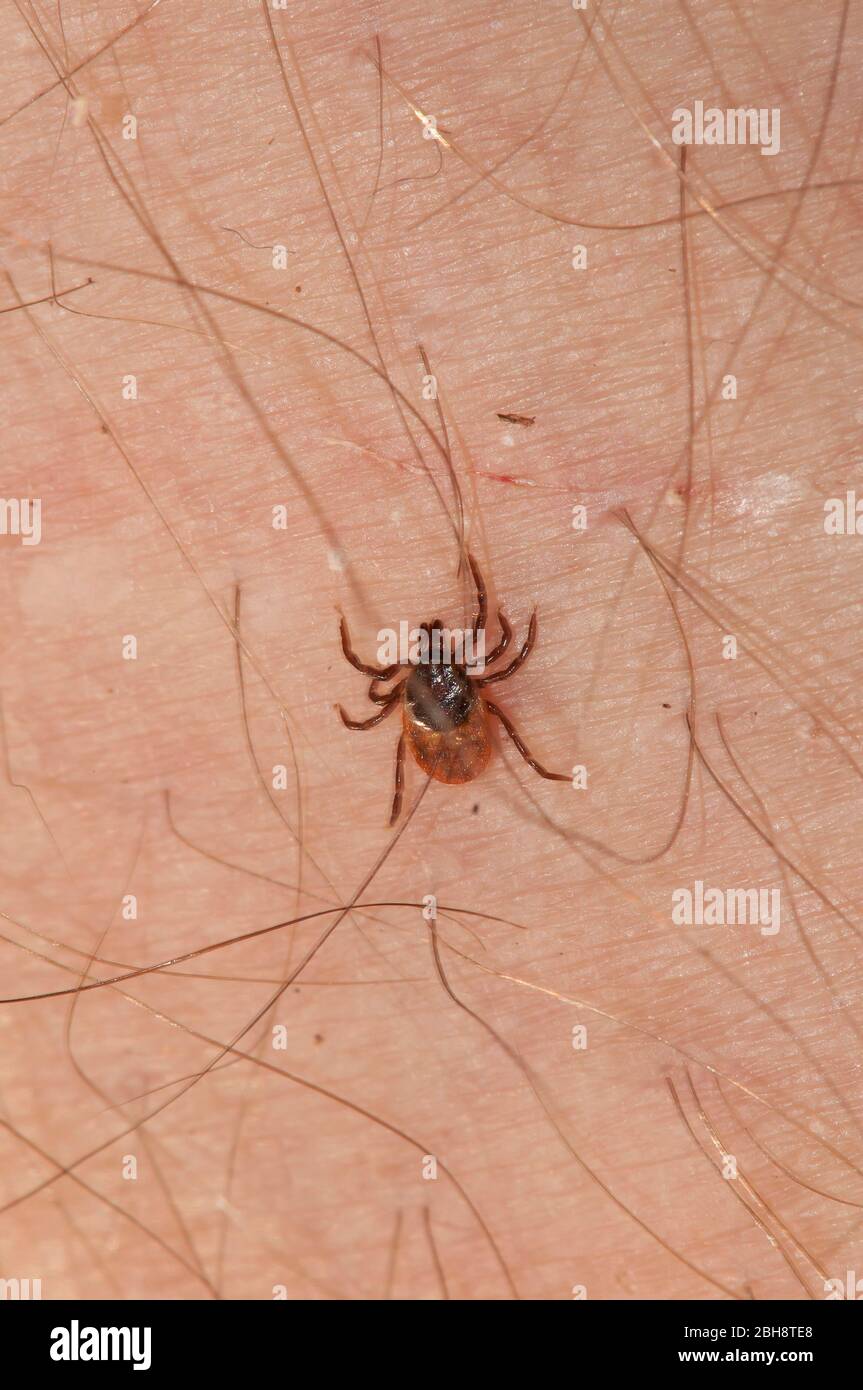 Tick, Ixodida, auf menschlicher Haut, Wirt, Bayern, Deutschland Stockfoto