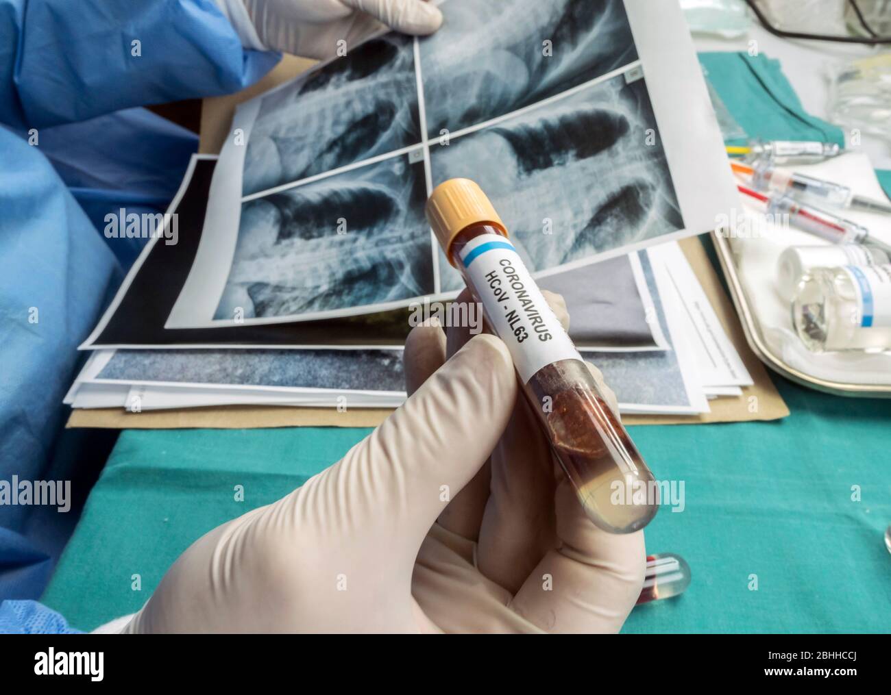 Wissenschaftler vergleicht Röntgenaufnahmen mit einer Ampulle Blut von SARS-Cov-2 von einem infizierten Patienten, konzeptionelle Bild Stockfoto