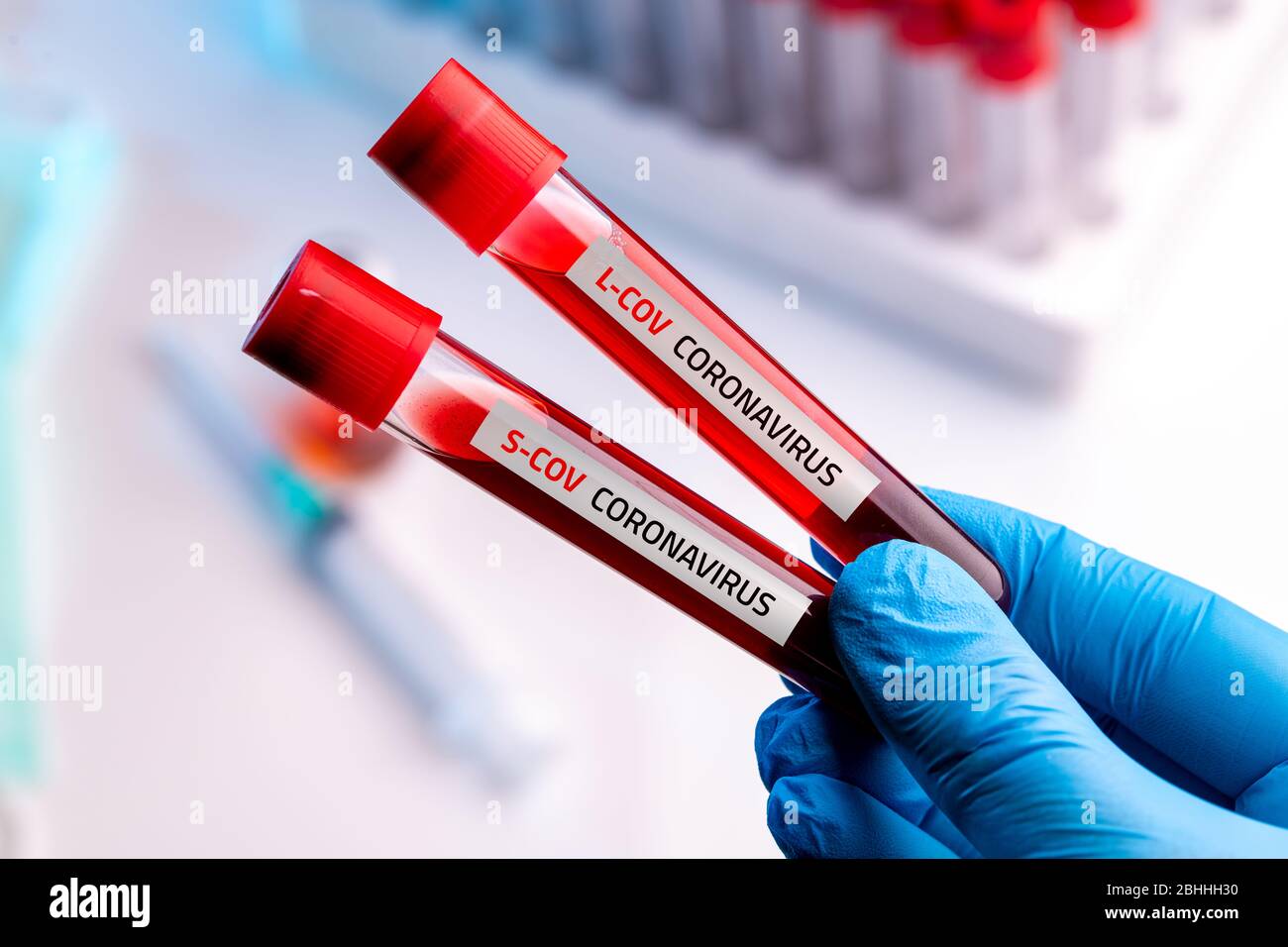 Arzt trägt medizinische Handschuhe, die einen Blutschlauch mit positiver neuer Version der Coronavirus 2019-nCoV S-Cov und L-Cov Blutprobe halten. Stockfoto