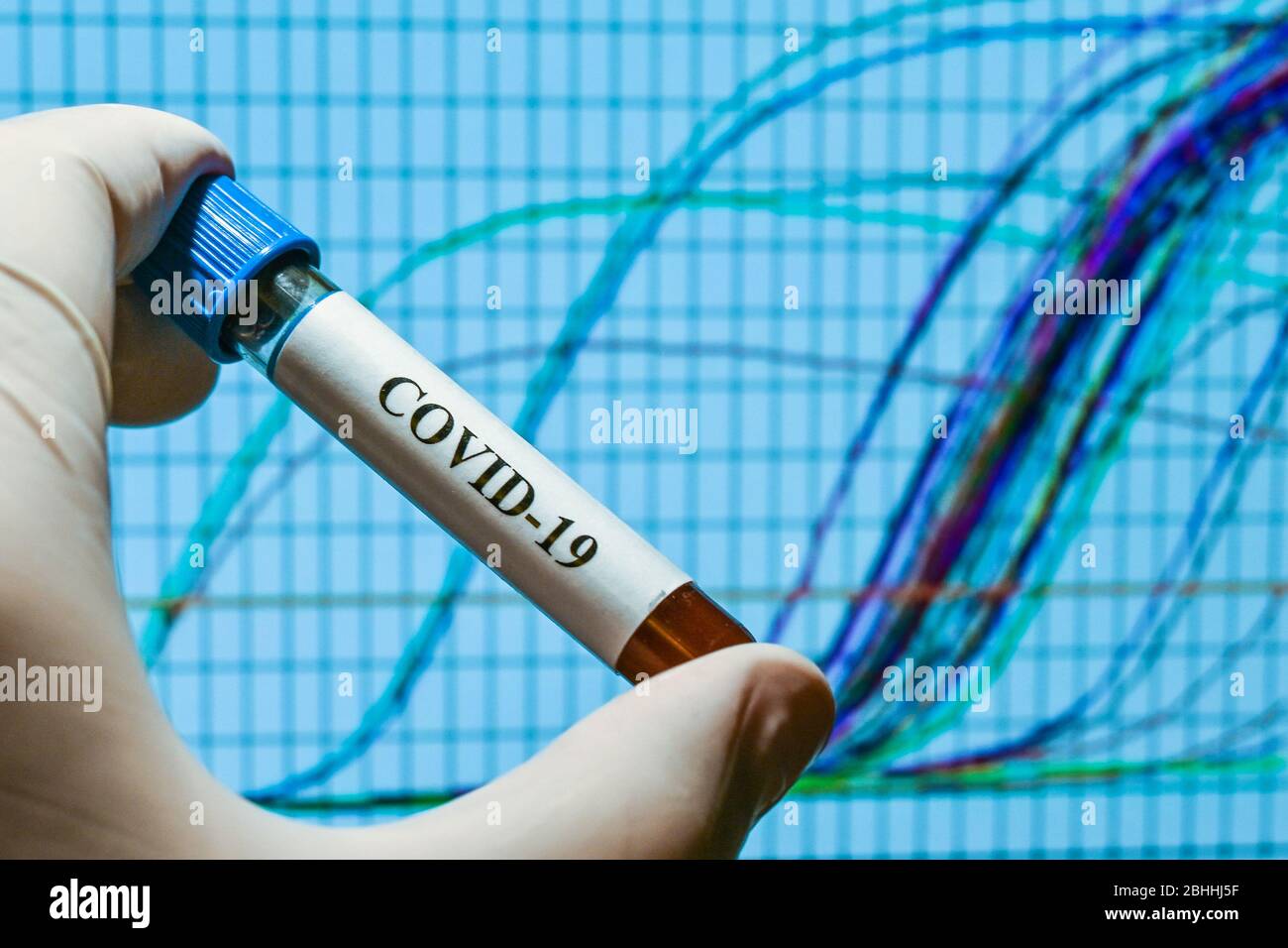 Real-Time PCR-Tests mit COVID-19. Ein Reagenzglas mit einer Probe auf dem Hintergrund von Amplifikationskurven. Stockfoto