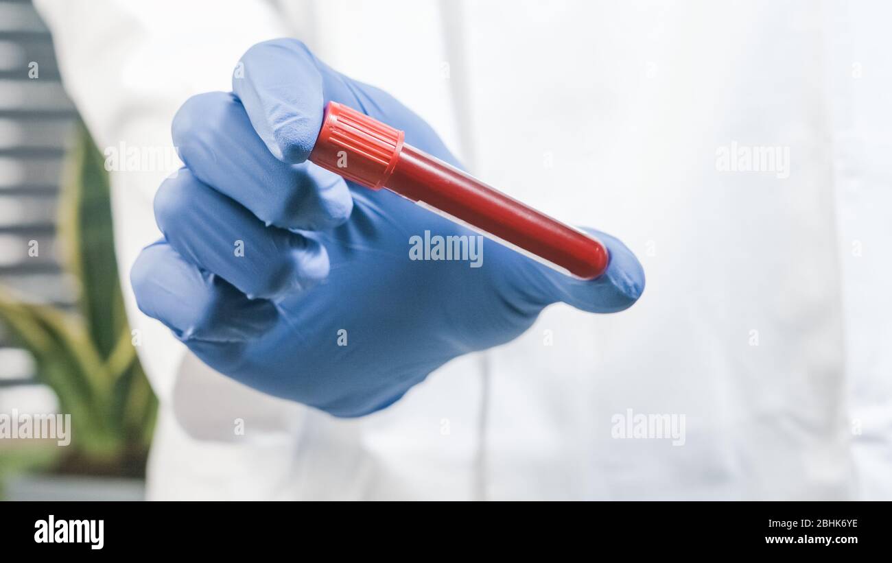 Arzt hält Blutprobenschlauch für die Prüfung in Schutzhandschuhen in einem Labor. Stockfoto