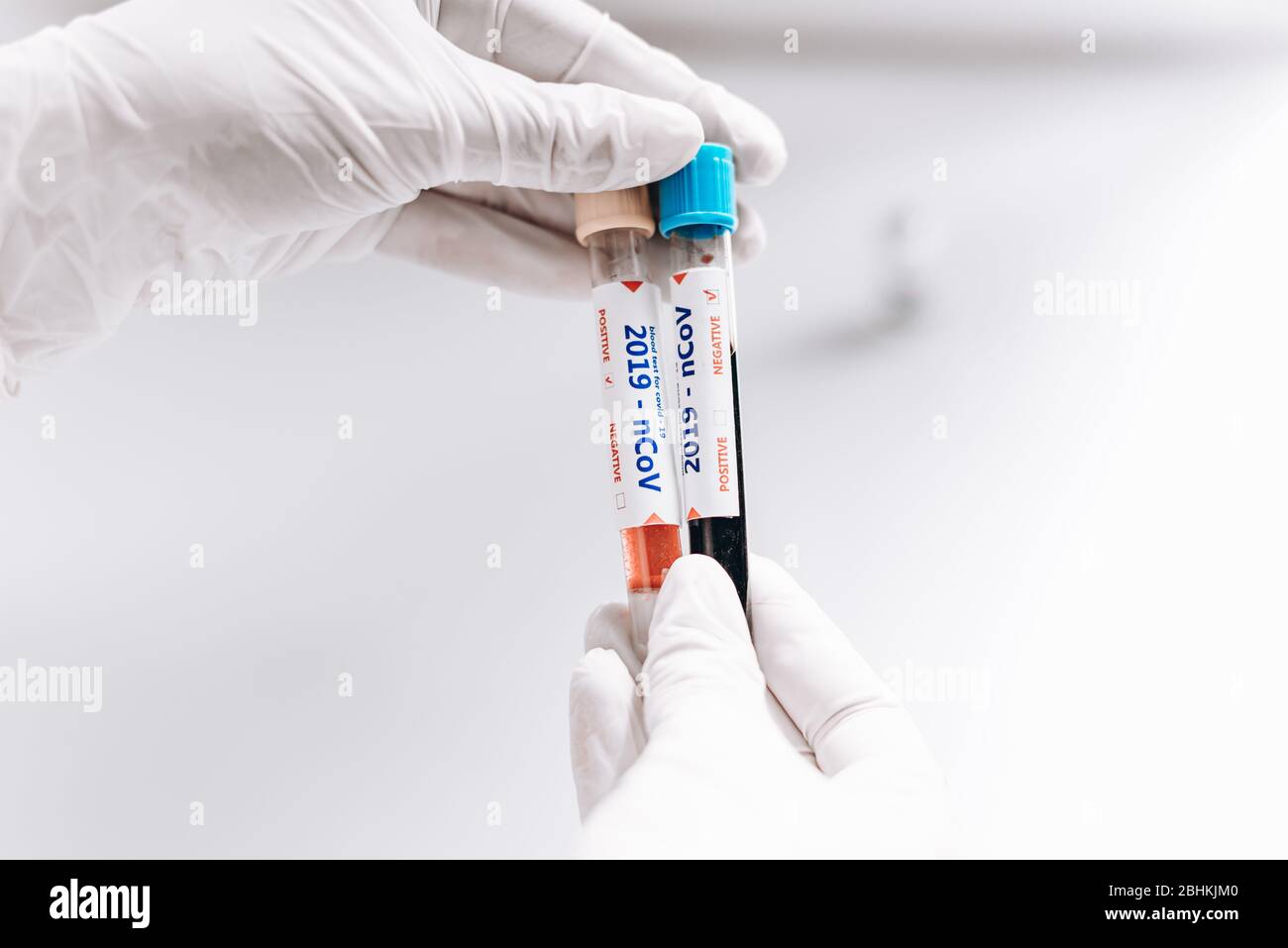 2019-nCoV Coronavirus. Positive und negative Blutprobe in der Hand des Arztes. Atemwegssyndrom. Coronavirus bricht aus Stockfoto