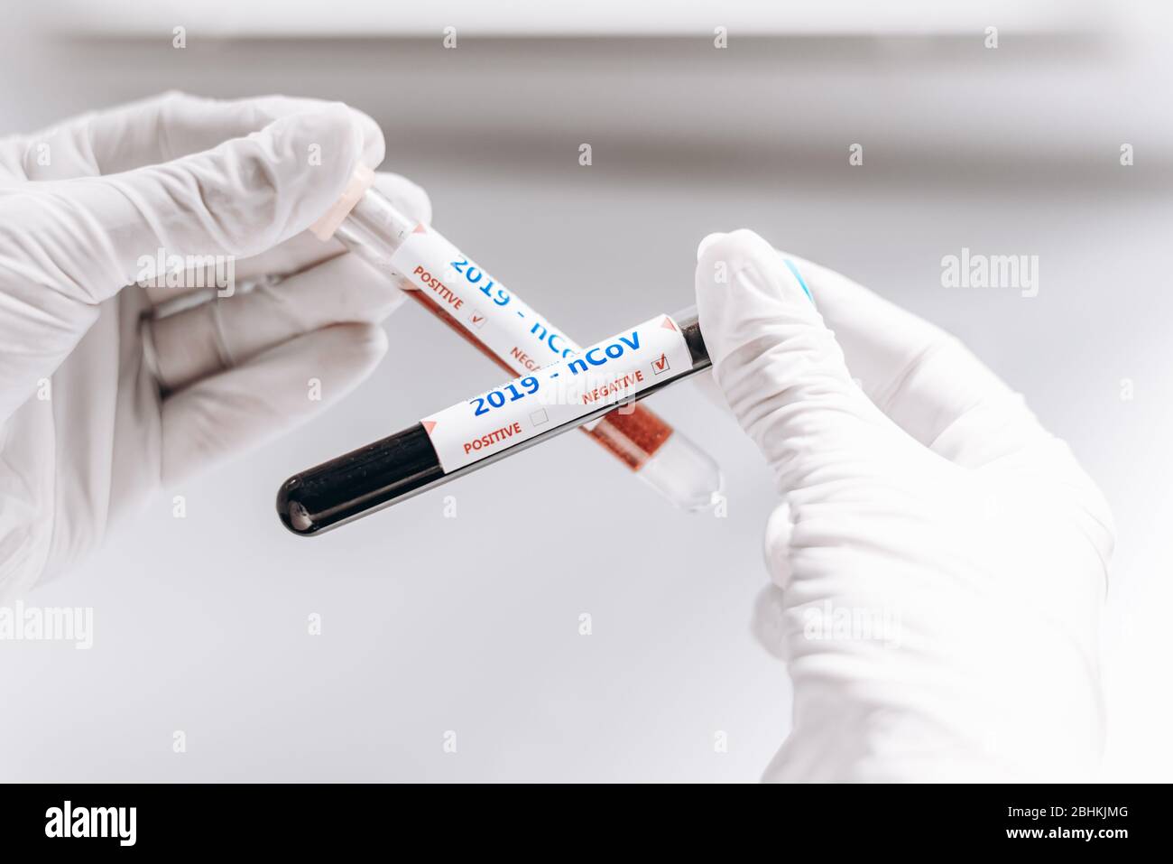2019-nCoV Coronavirus. Positive und negative Blutprobe in der Hand des Arztes. Atemwegssyndrom. Coronavirus bricht aus Stockfoto