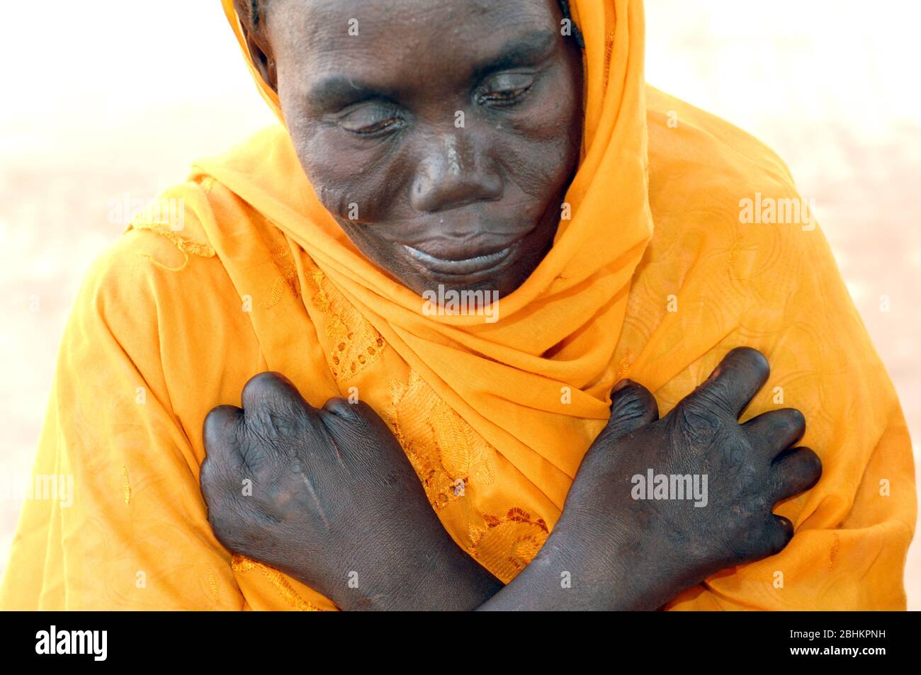 Was Ist Lepra Für Eine Krankheit Mycobacterium leprae bacteria -Fotos und -Bildmaterial in hoher