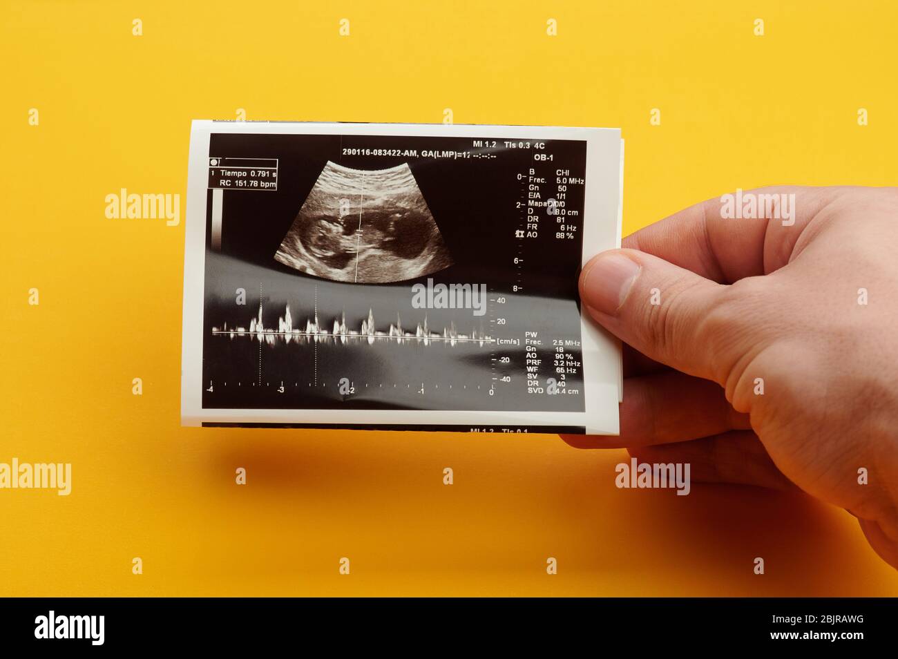 Überprüfung des zukünftigen Herzschlags des Babys per Ultraschalluntersuchung Stockfoto