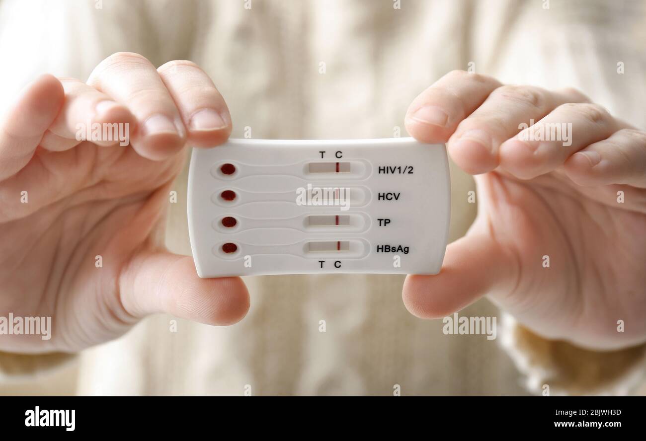 Syphilis Fotos und Bildmaterial in hoher Auflösung Alamy