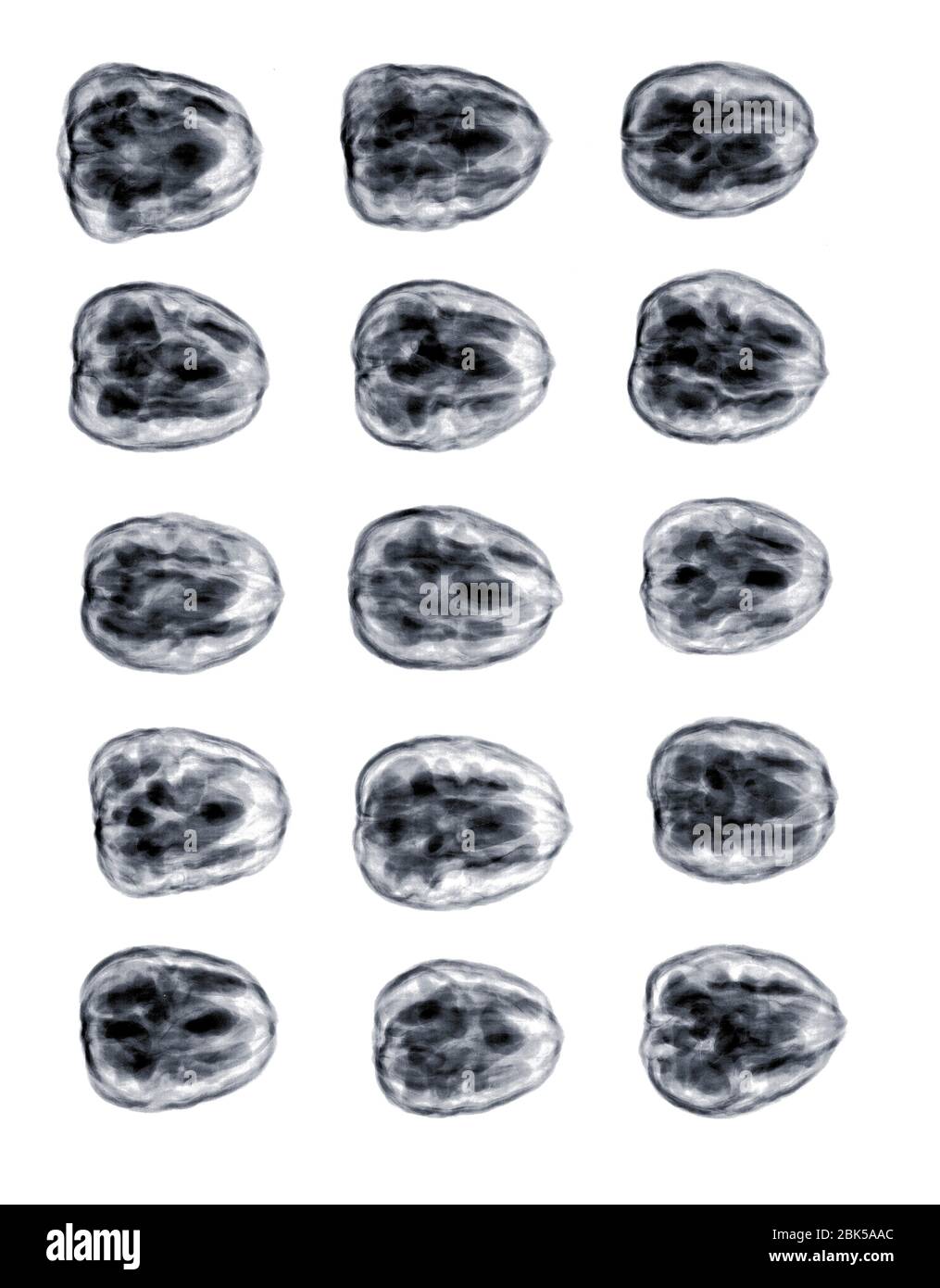 Walnüsse in einer Gruppe, Röntgen. Stockfoto