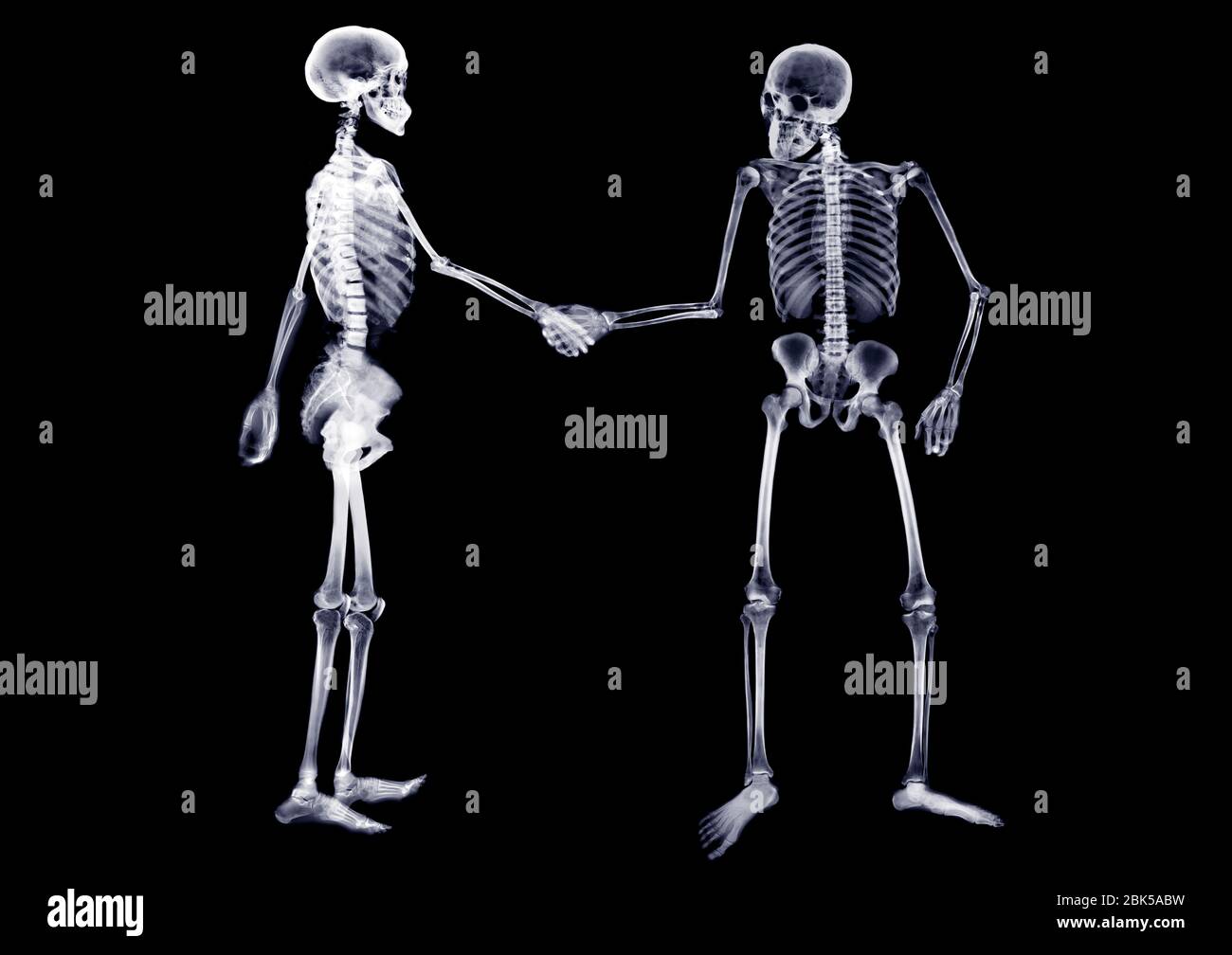 Zwei Skelette schütteln die Hände, Röntgen. Stockfoto