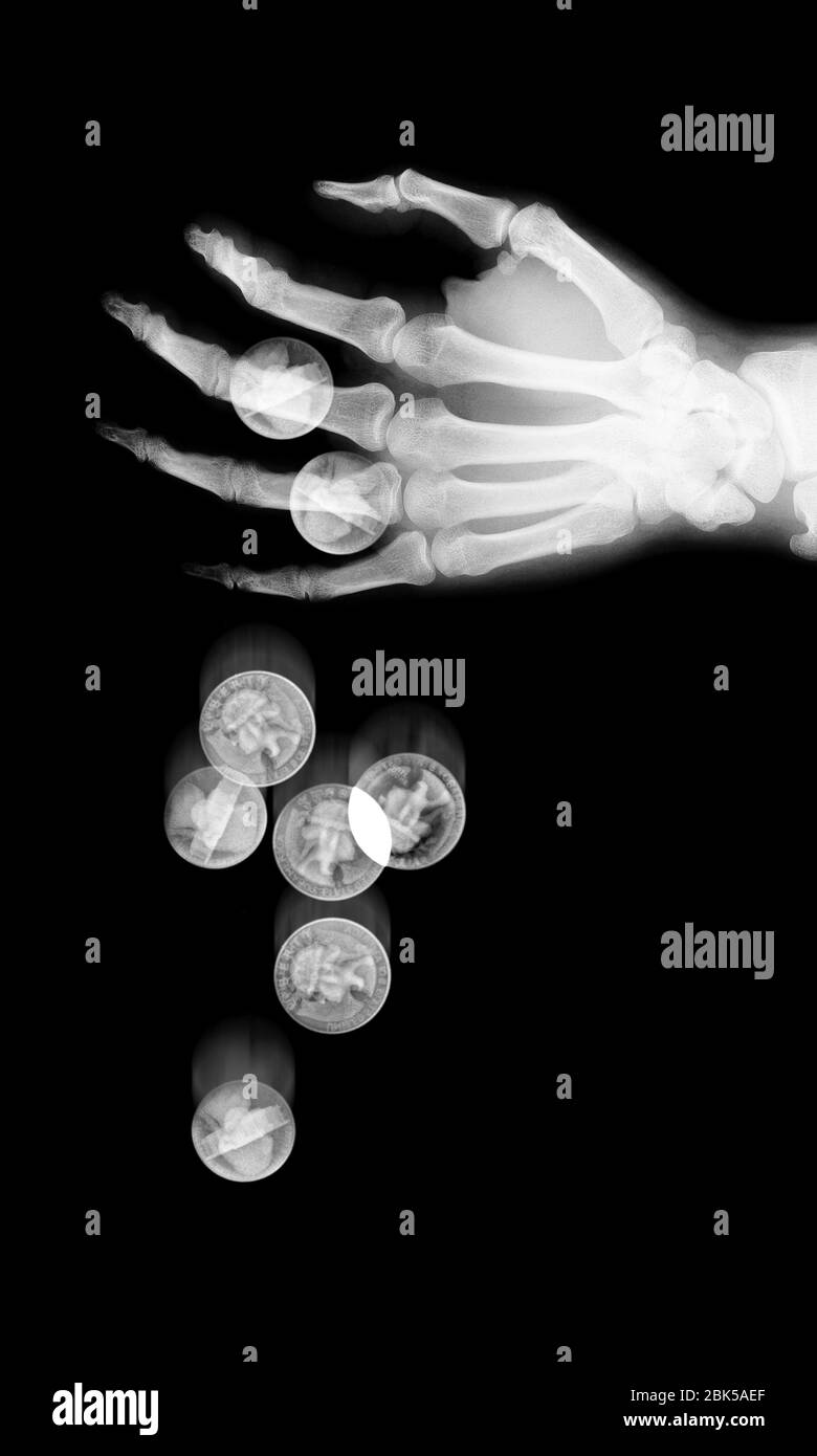 Münzen fallen von Hand, Röntgenstrahlen. Stockfoto