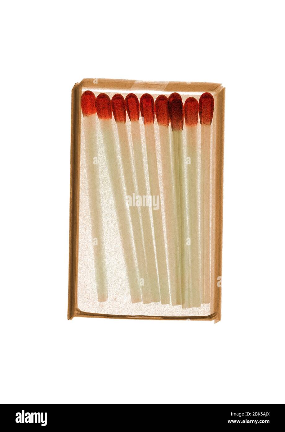 Schachtel mit Streichhölzern, farbige Röntgenstrahlung. Stockfoto