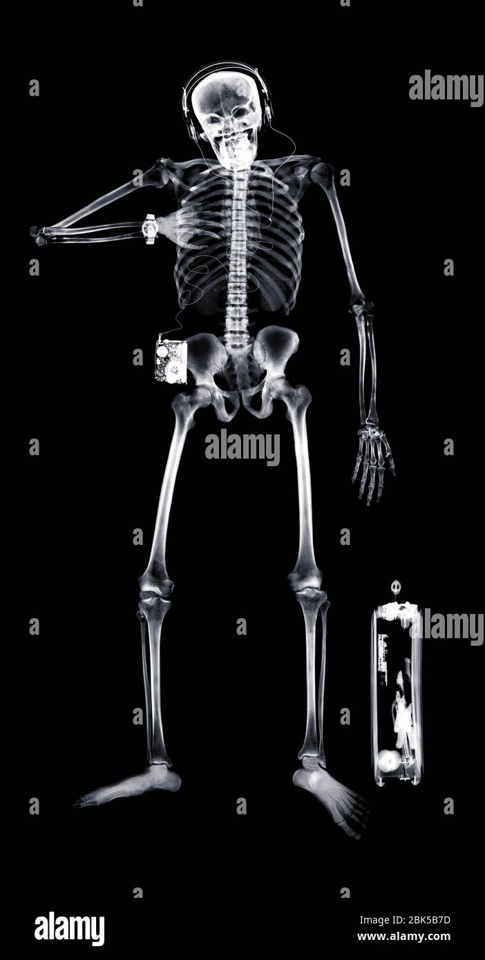 Menschliches Skelett mit Aktentasche und Kopfhörer, Röntgen. Stockfoto