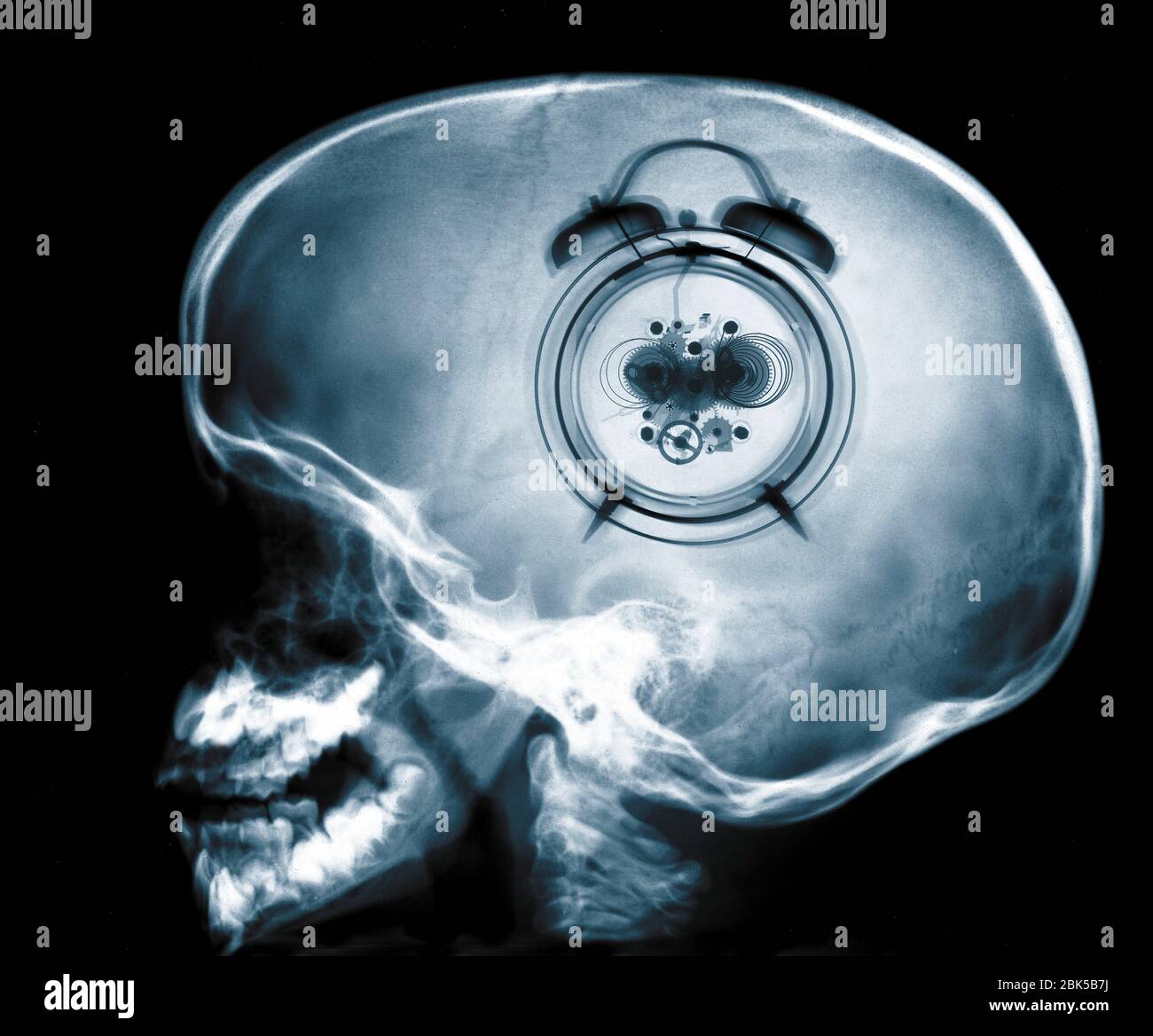 Menschlicher Schädel und Uhr, Röntgenstrahlung. Stockfoto