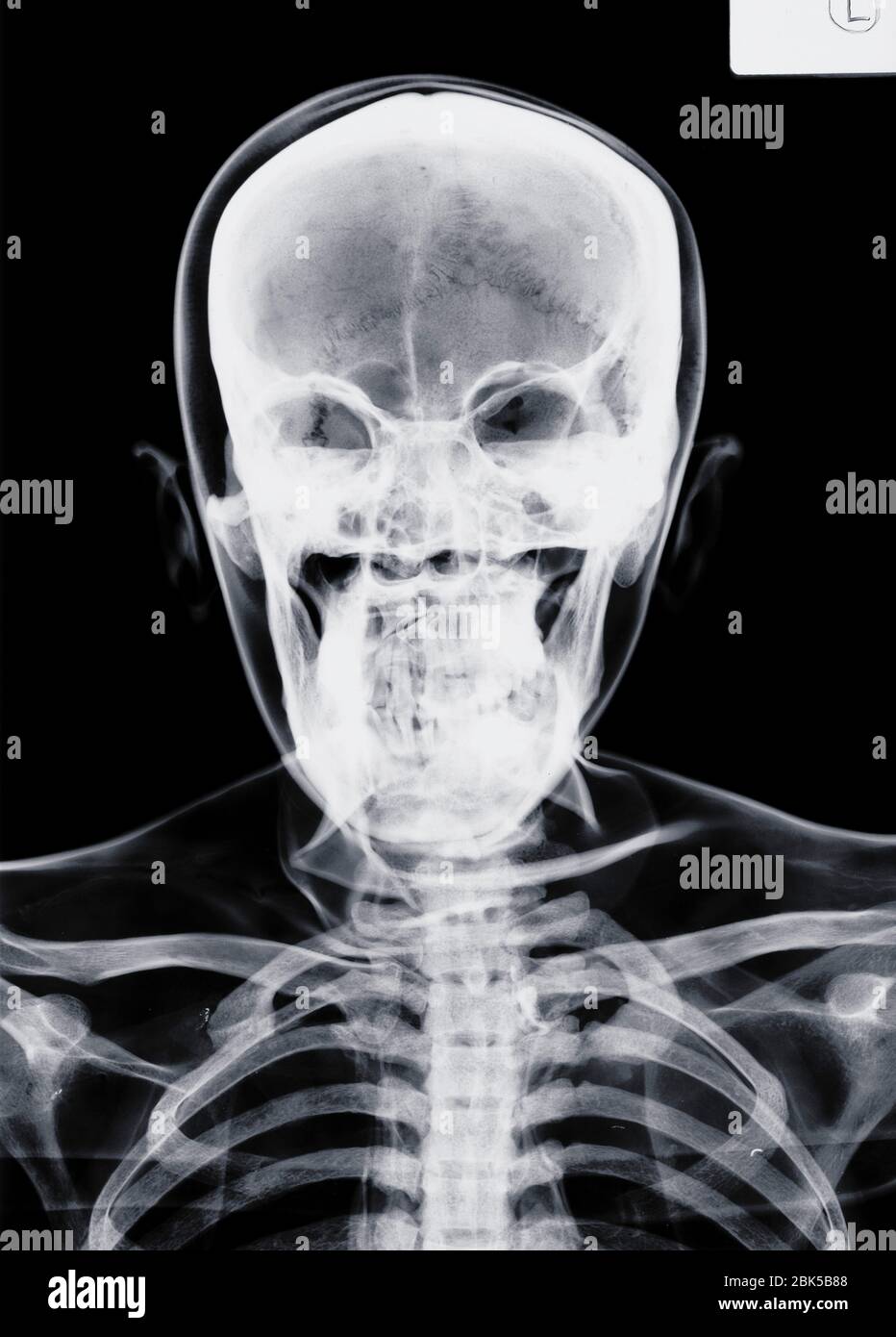 Menschlicher Schädel, X-Ray. Stockfoto