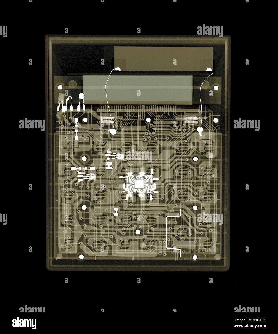 Elektronischer Rechner, Röntgen. Stockfoto