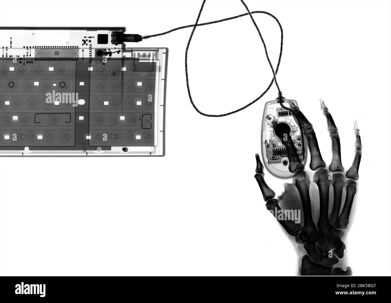 Hand mit Tastatur und Maus, Röntgen. Stockfoto