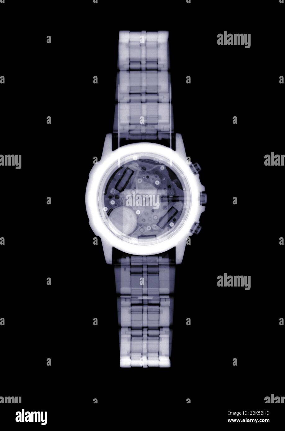 Armbanduhr, Röntgen. Stockfoto