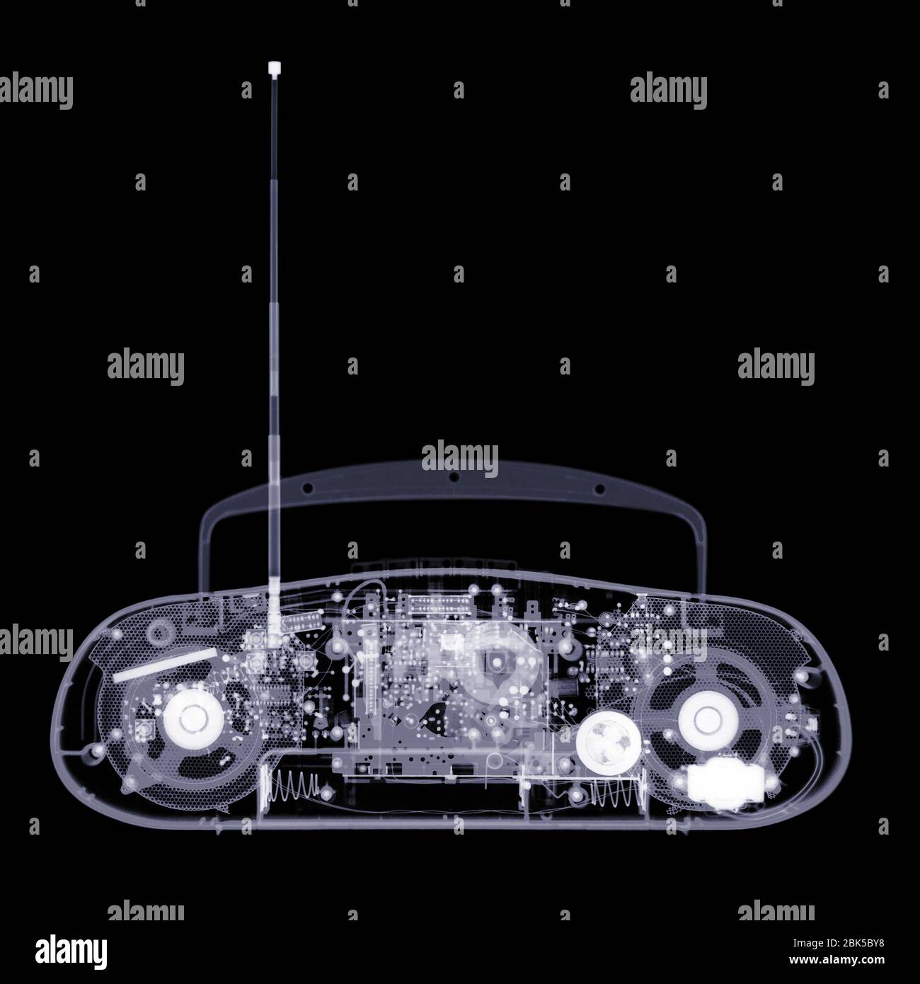 Tragbares Stereo-Gerät, Röntgen. Stockfoto