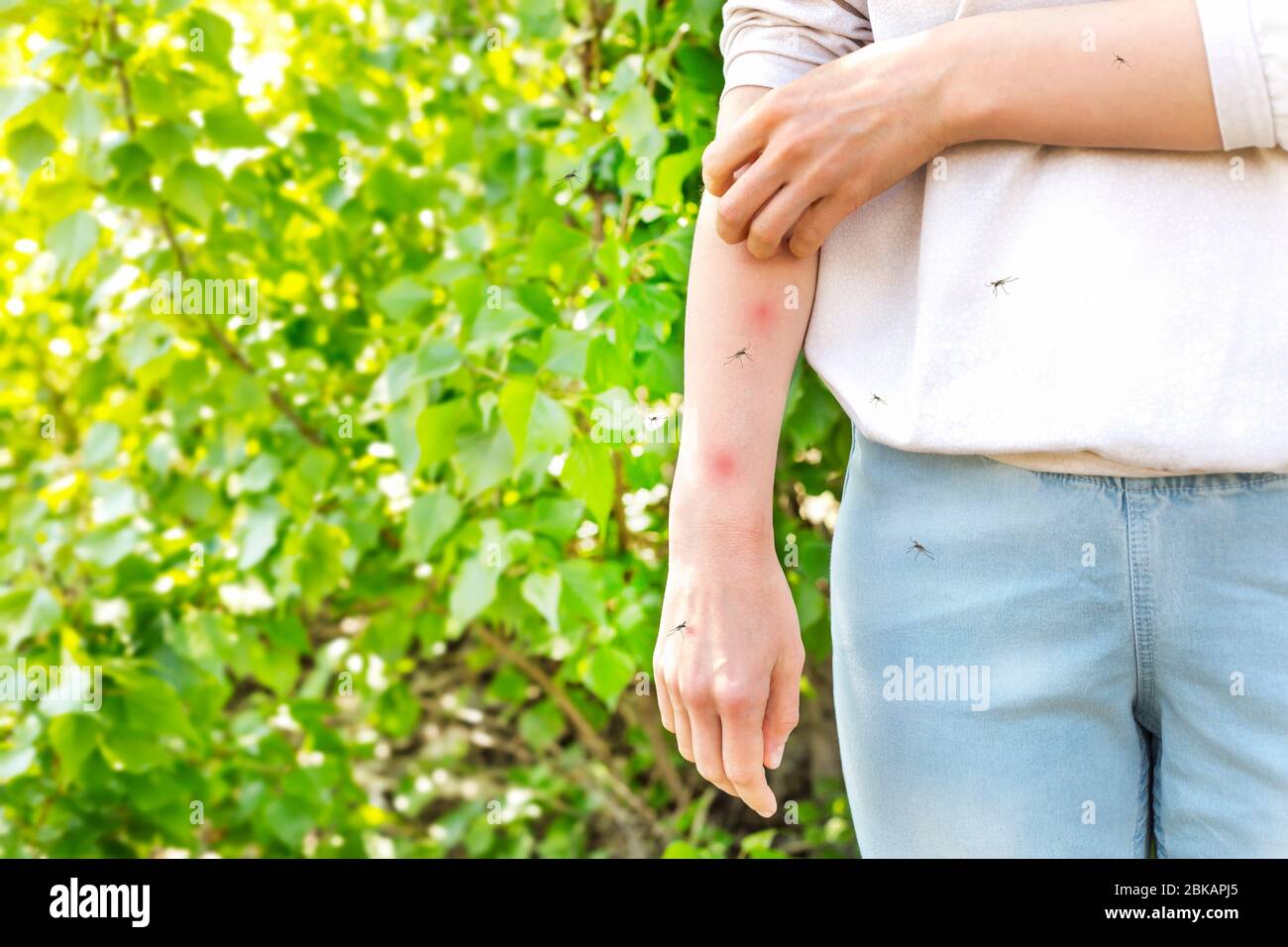 Mückenstiche verursachen Allergien bei Frauen. Juckende Haut. Stockfoto