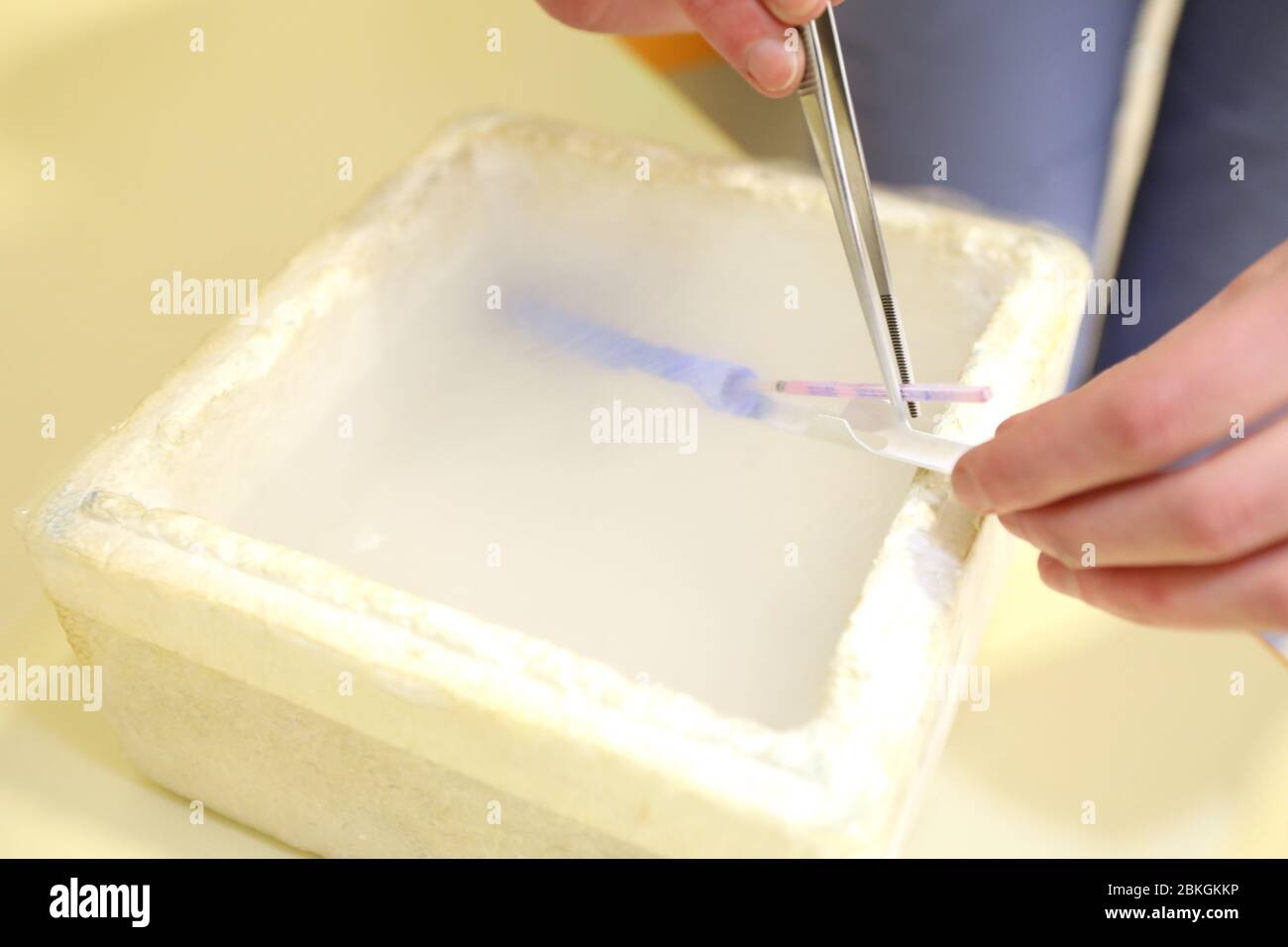 Klinik für Reproduktionsmedizin. Künstliche Befruchtung. Klinik für künstliche Empfängnis. Spermien frieren. Lagerung von Flüssigstickstoff. Stockfoto