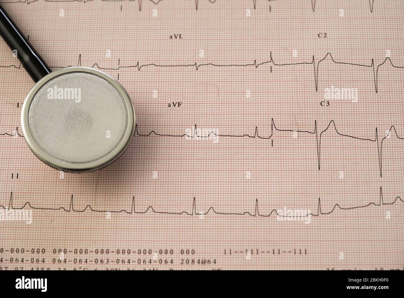 Stethoskop auf medizinischen Bericht Stockfoto