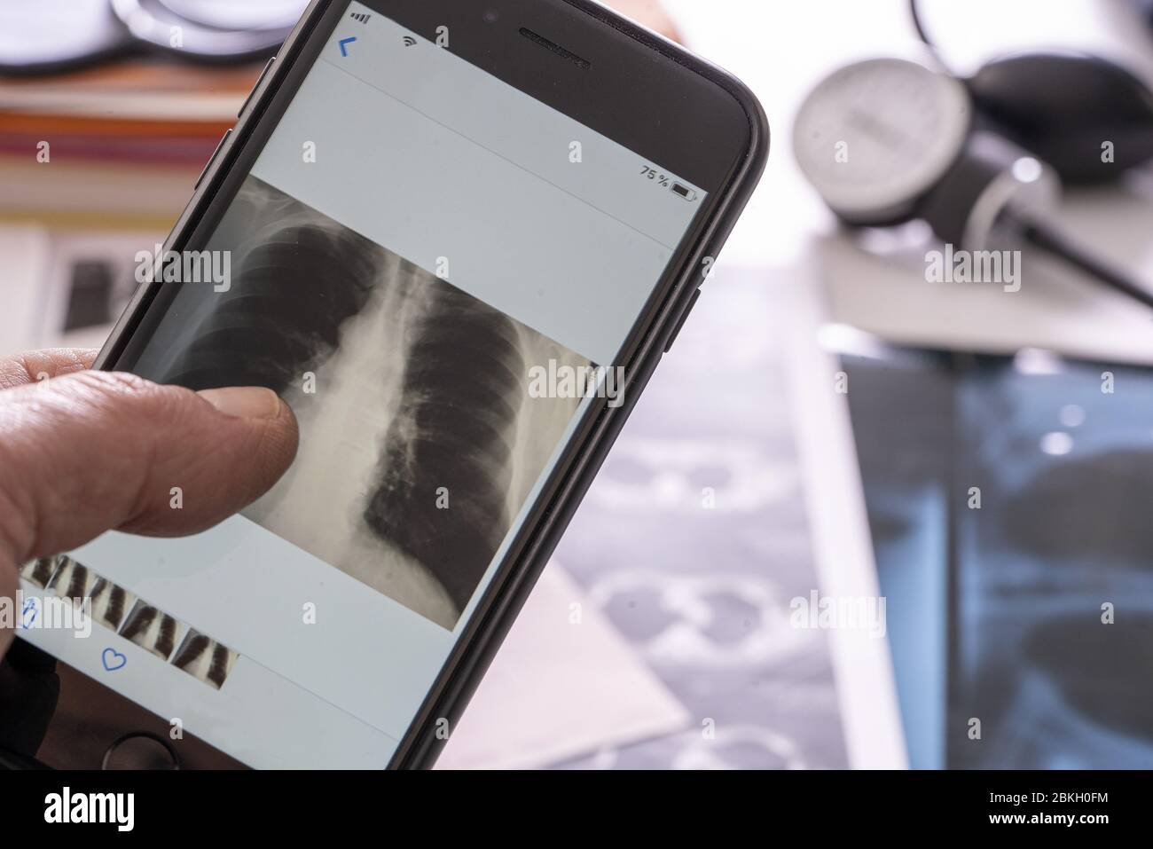 Hand der Person, die Röntgenaufnahmen auf dem Smartphone überprüft Stockfoto