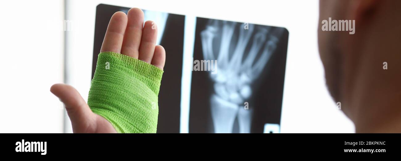 Mann mit verletztem Arm Stockfoto