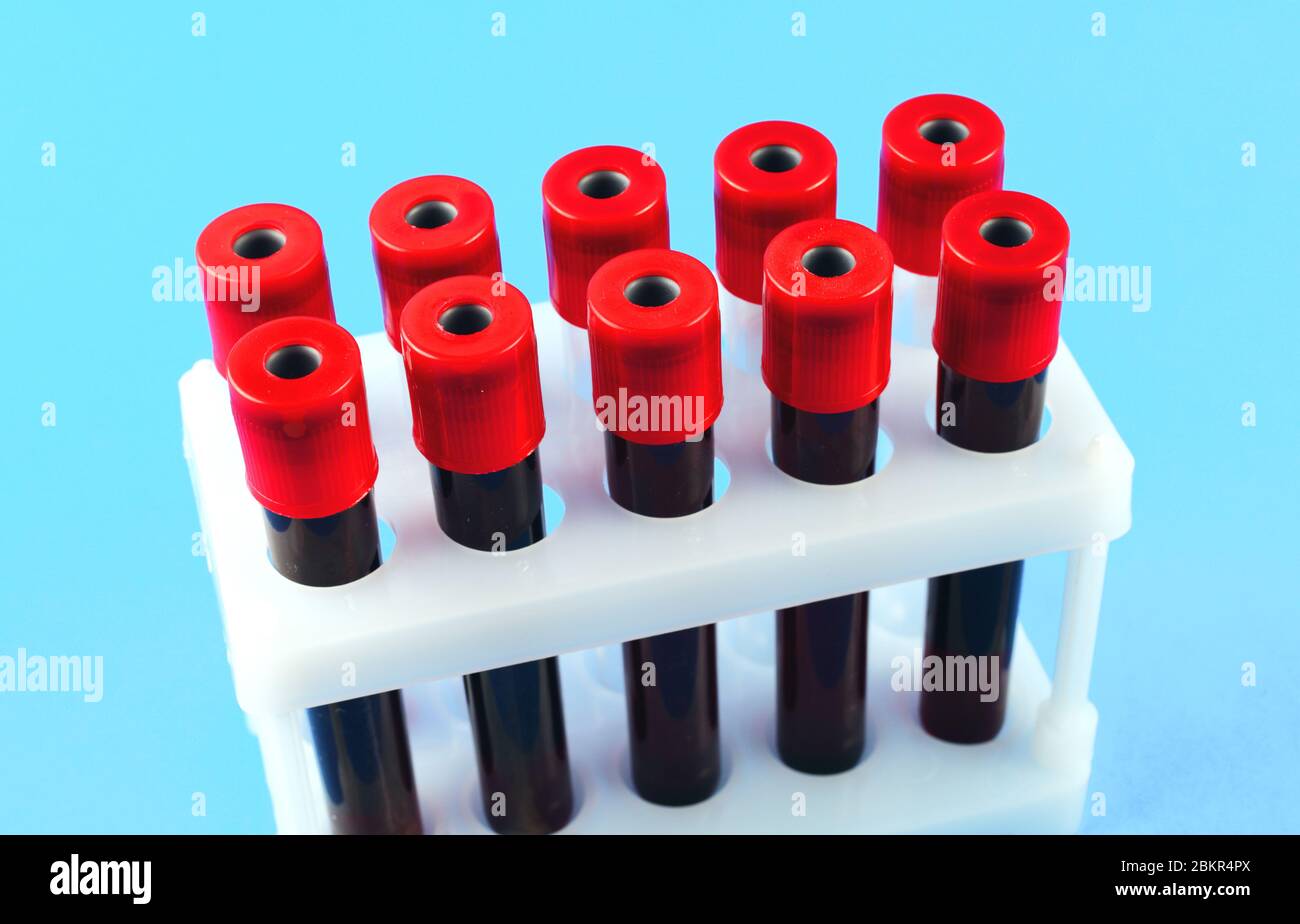 Blutentnahme-Vakuumröhrchen auf blauem Hintergrund Stockfoto