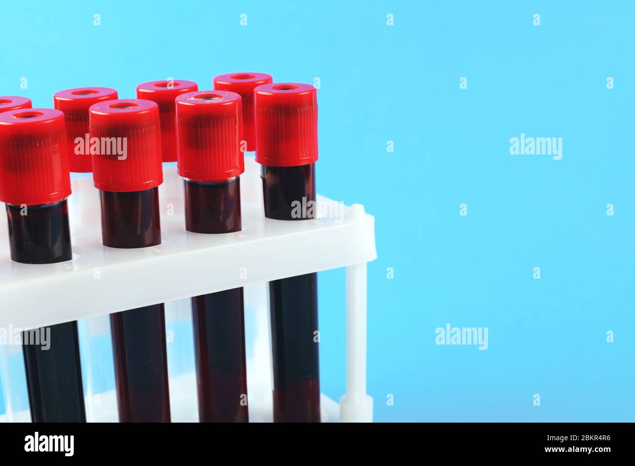 Blutentnahme-Vakuumröhrchen auf blauem Hintergrund mit Platz für Text Stockfoto
