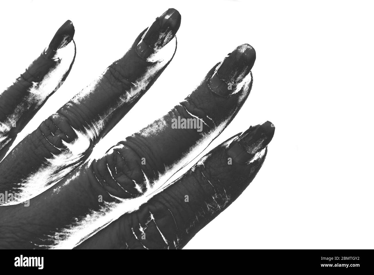 Überwucherten Nägel mit verwöhnter Maniküre. Weiblicher Lebensstil während der Quarantäne. Stockfoto