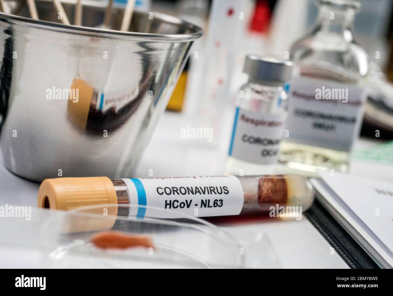 Fläschchen mit einer Probe von Kovid-19-Coronavirus infizierter Person in einem Labor, konzeptionell Stockfoto