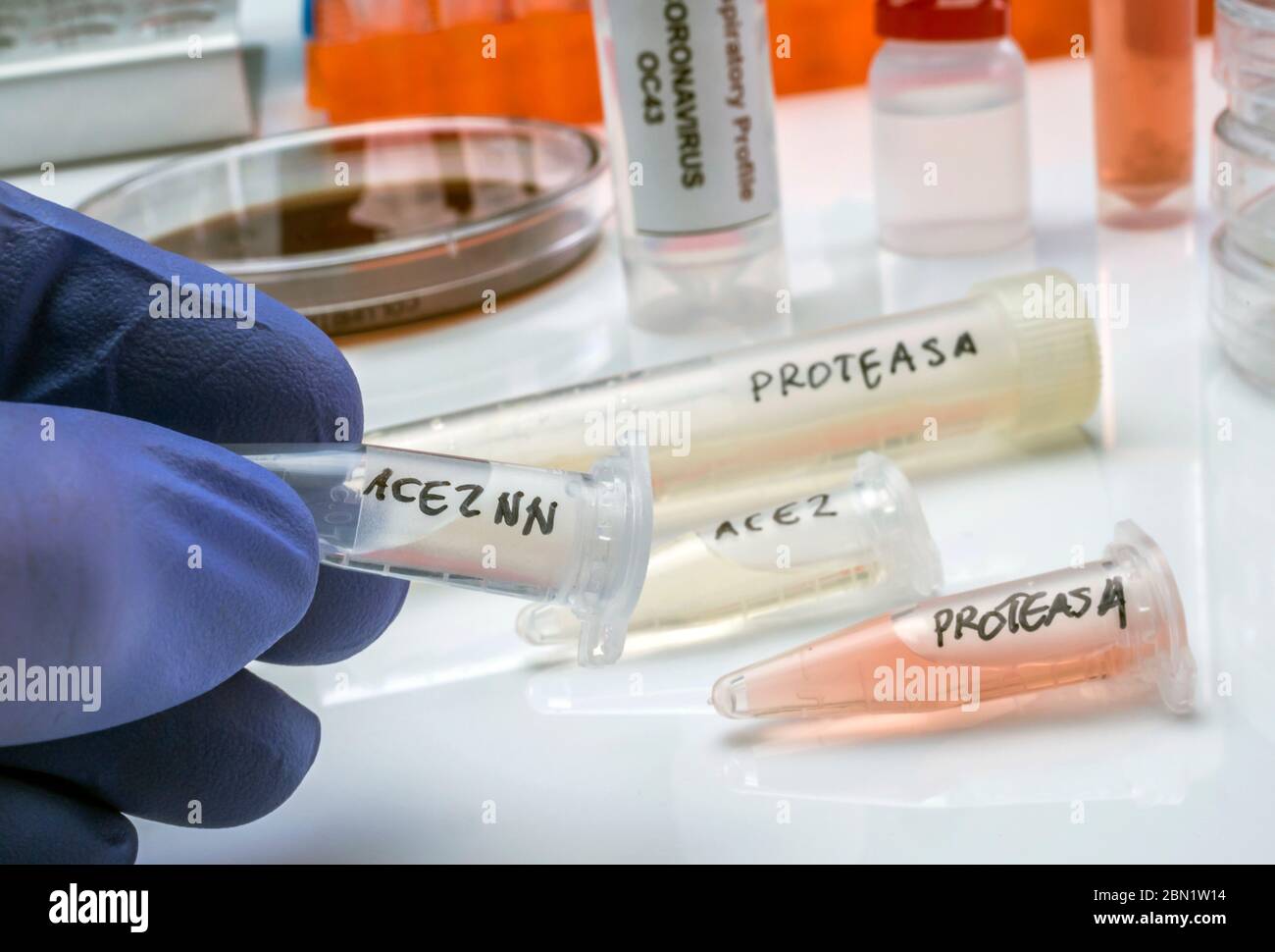 Mehrere Fläschchen mit löslichen Protease-Proteinen zur Aktivierung des Coronavirus-Trypsin-ähnlichen Proteins des schweren akuten respiratorischen Syndroms (SARS) beim Menschen Stockfoto