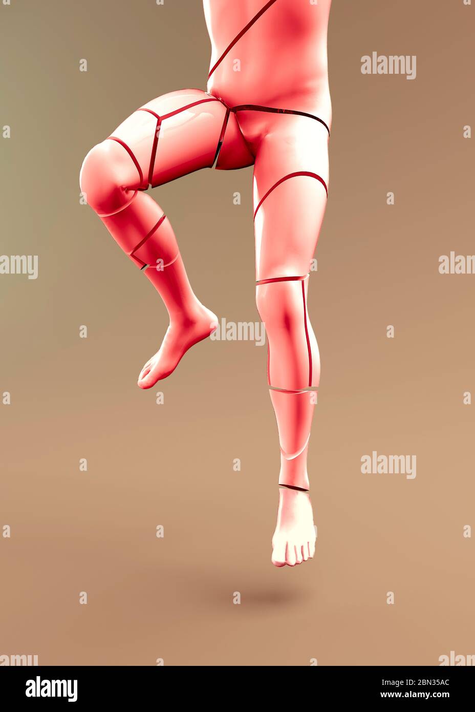 Osteogenesis imperfecta, die brüchige Knochenerkrankung, ist eine Gruppe genetischer Störungen, die hauptsächlich die Knochen betreffen. Es führt zu Knochen, die leicht brechen. 3d Stockfoto