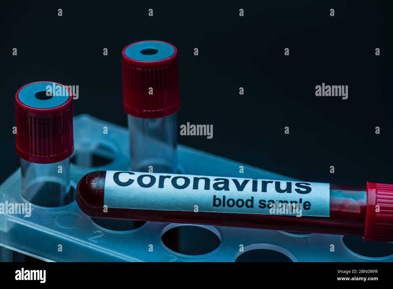 Probenröhrchen mit Coronavirus-Blut-Beschriftung auf Reagenzglasgestell auf dunkel Stockfoto