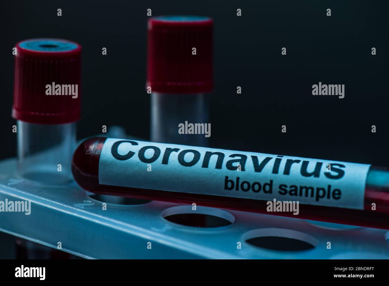 Selektiver Fokus des Probenröhrchens mit Coronavirus-Blutprobe Beschriftung auf Reagenzglasgestell auf dunkel Stockfoto