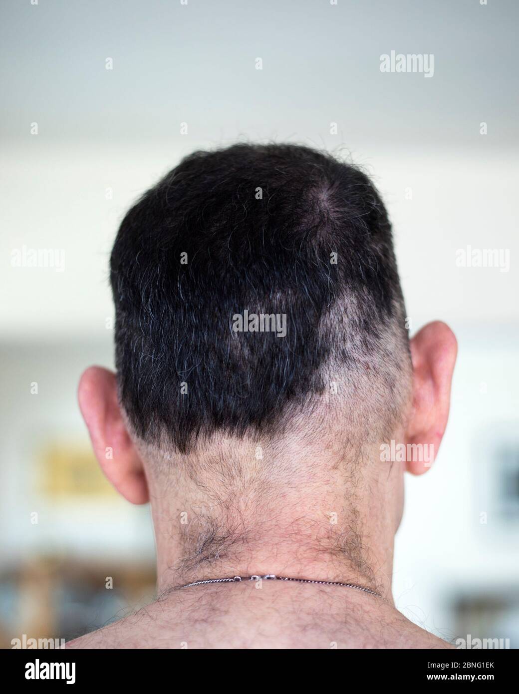 Schlechter Haarschnitt selbst gemacht durch Mann, der während der COVID 19 Pandemie in Isolation zu Hause bleibt. Stockfoto