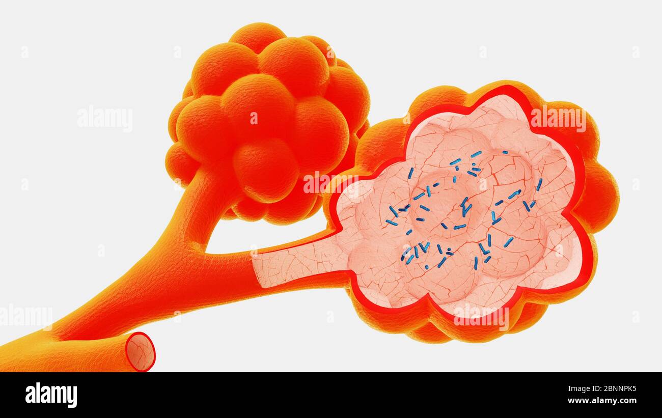 Alveolarfortsatz Stockfotos und bilder Kaufen Alamy