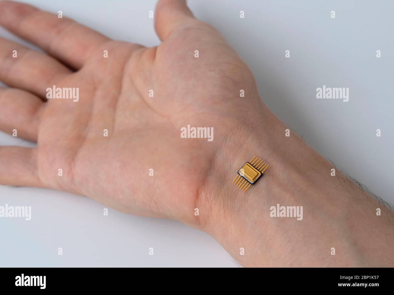 mikrochip implantierung stockfotos und bilder kaufen alamy