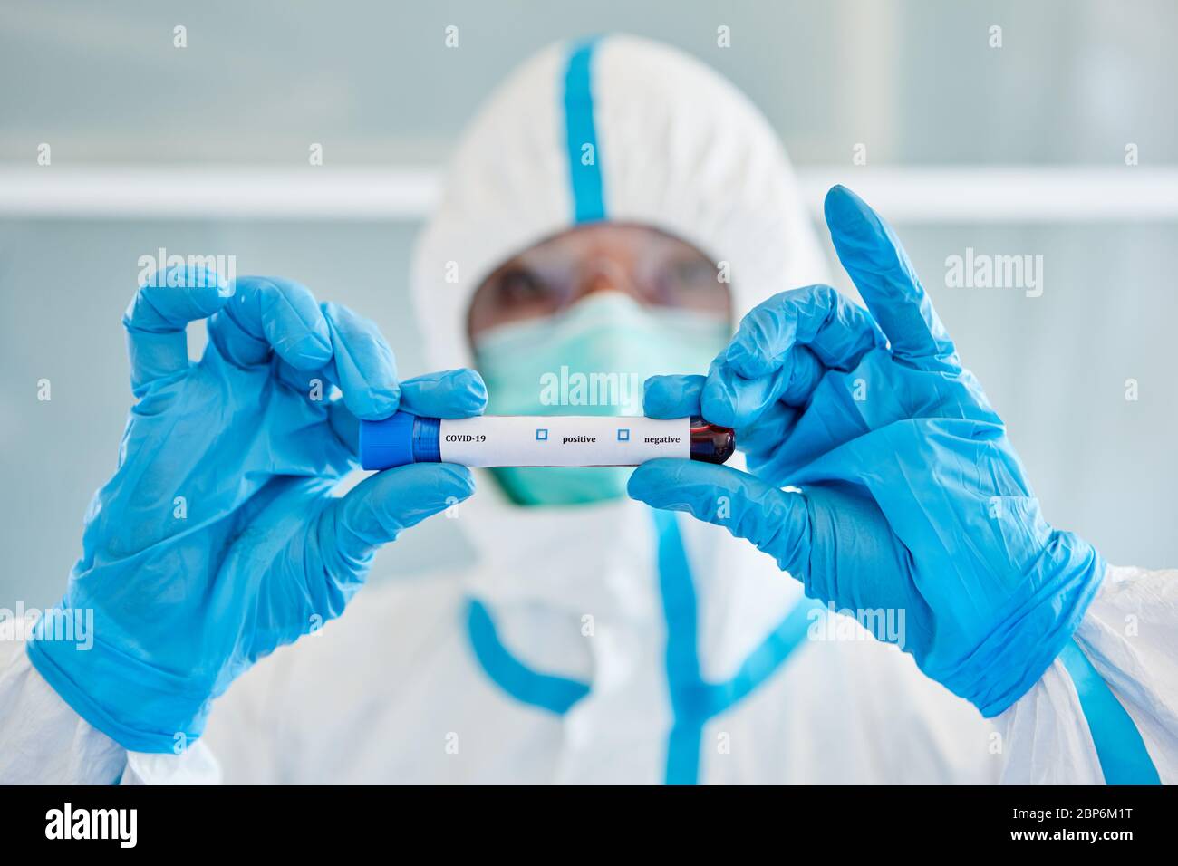 Laborwissenschaftler hält Blutproben während Coronavirus und Covid 19 Pandemie Stockfoto