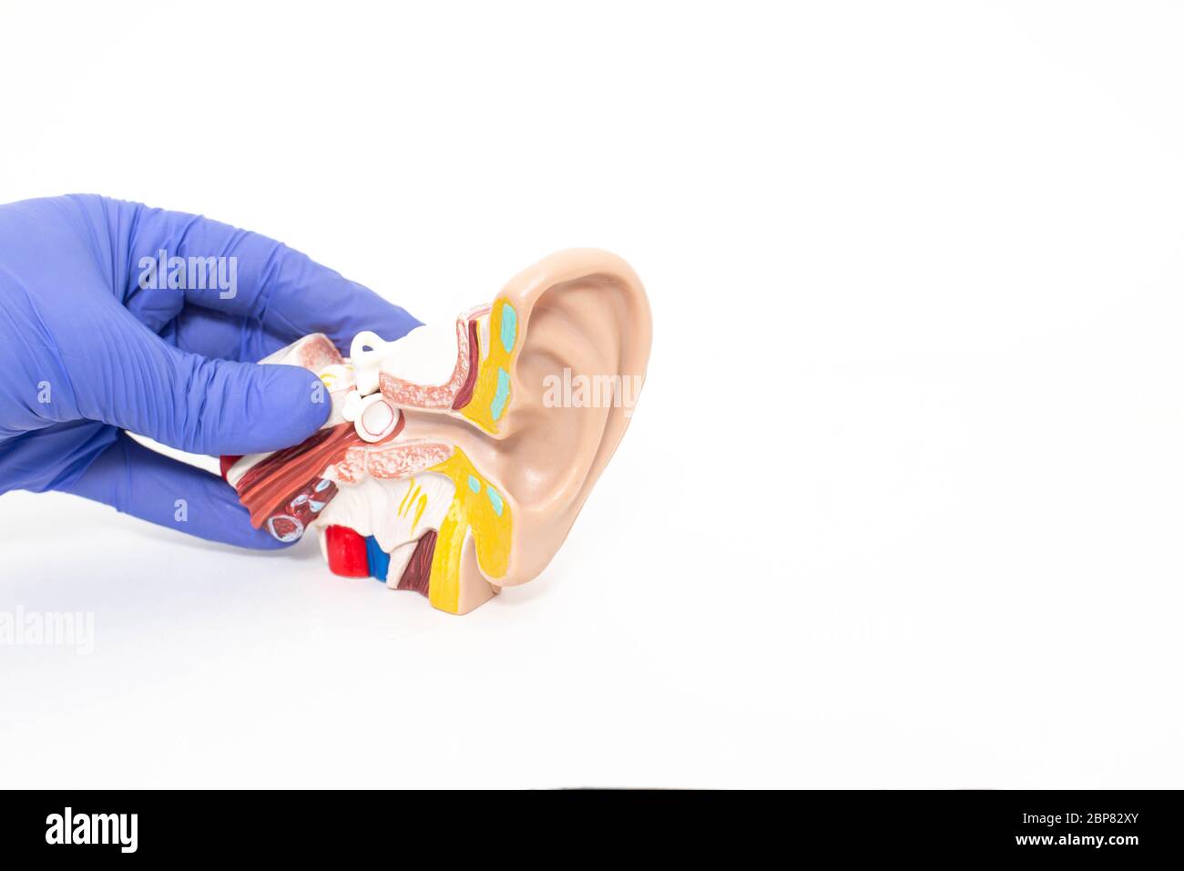 Doktor otolaryngologist hält ein verspieltes menschliches Ohr auf einem weißen Hintergrund. Das Konzept der Behandlung von Otitis media und anderen Ohrerkrankungen, Stockfoto