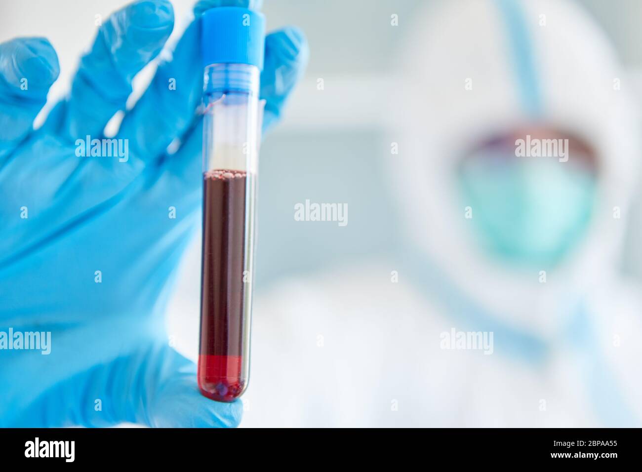 Wissenschaftler im Labor stoppt Blutentnahme während der Coronavirus und Covid 19 Pandemie Stockfoto