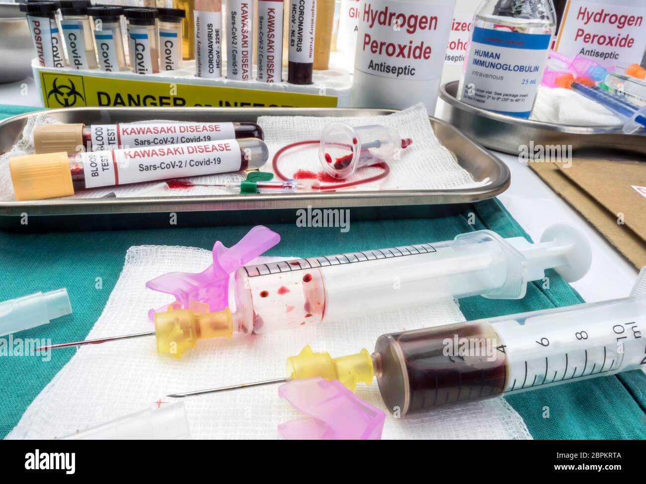 Blutproben zur Behandlung der mit SARS-CoV-2 zusammenhängenden Kawasaki-Krankheit bei Kindern unter fünf Jahren, konzeptionelles Bild Stockfoto
