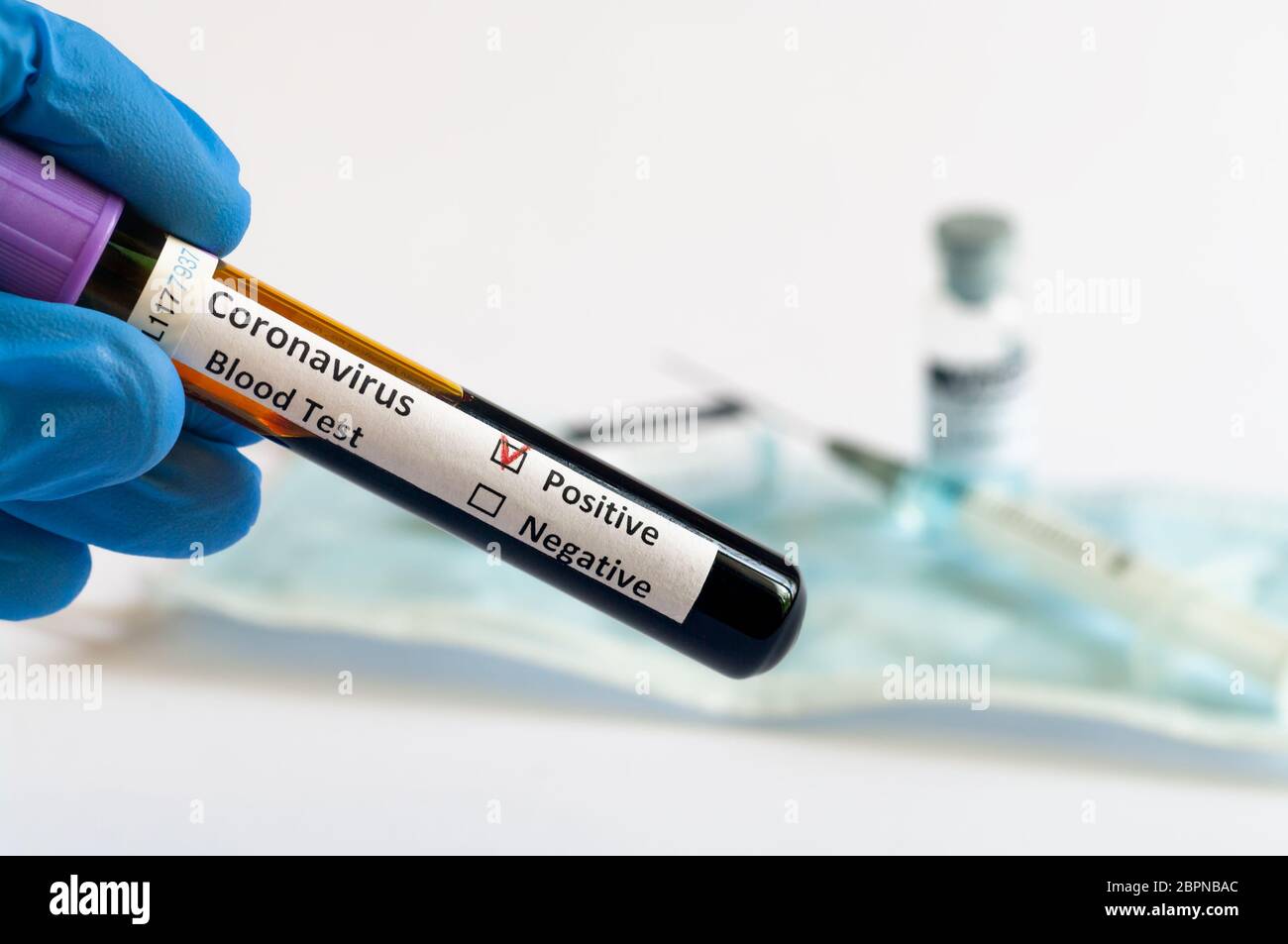 Hand-Holding-Tests Patienten Blutproben für Coronavirus Ausbruch (COVID-19) im Labor, New Coronavirus 2019-nCoV Stockfoto