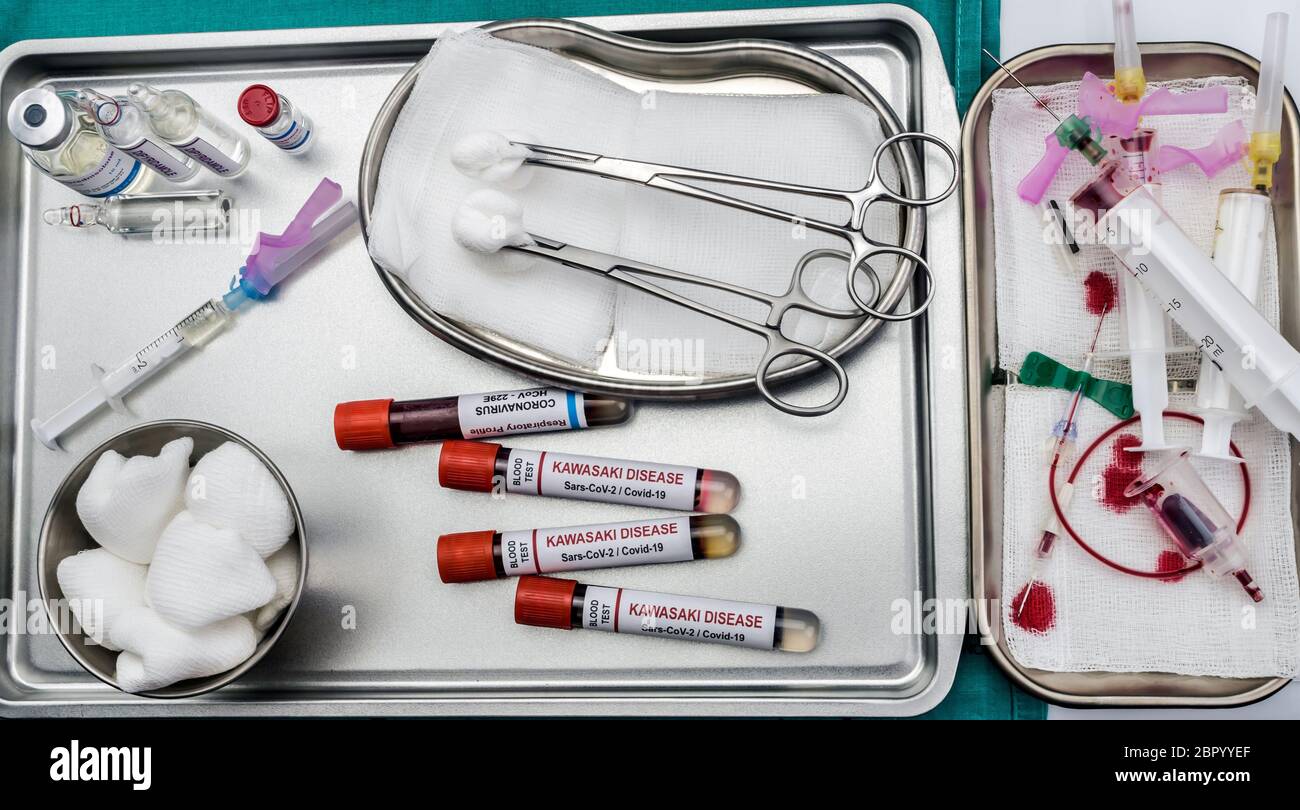 Blutproben zur Behandlung der mit SARS-CoV-2 zusammenhängenden Kawasaki-Krankheit bei Kindern unter fünf Jahren, konzeptionelles Bild Stockfoto