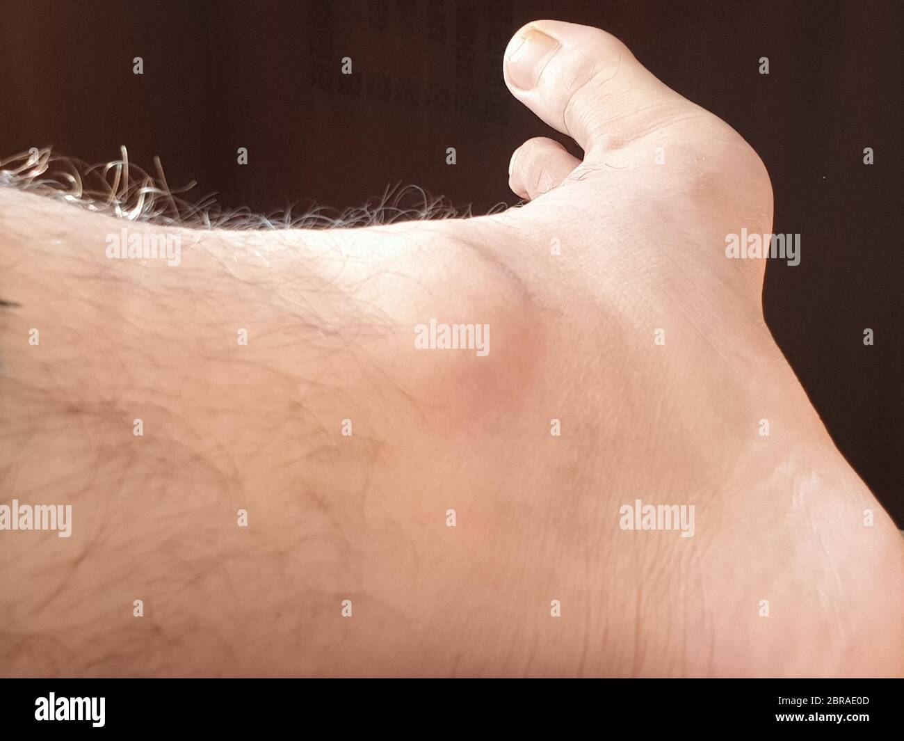 Knöchel und Fußseite mit fünf Fingern färben sich indisch braun mit schwarzem Hintergrund Stockfoto