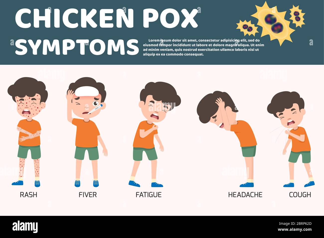 Kinder haben Windpocken Infografik, Poster Kinder Fieber und Windpocken Symptome und Prävention. Gesundheit und medizinische Cartoon Charakter Vektor Stock Vektor