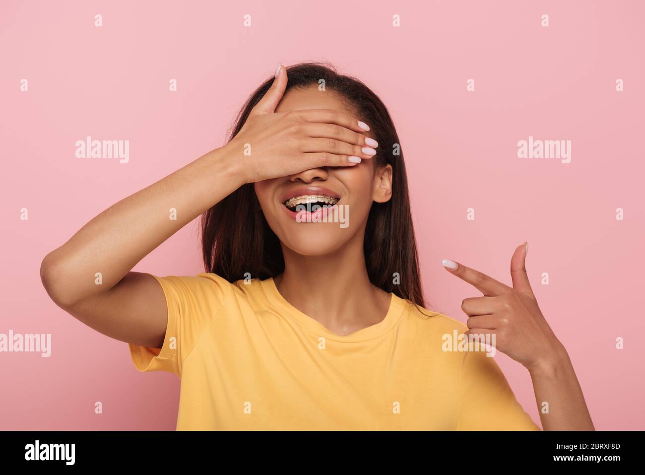 Fröhliches afroamerikanisches Mädchen, das Augen mit der Hand bedeckt, während es mit dem Finger auf Zahnspangen auf ihren Zähnen zeigt, die auf rosa isoliert sind Stockfoto