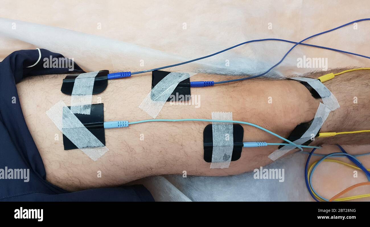 Elektrostimulation des Quadrizeps als Physiotherapie Stockfoto